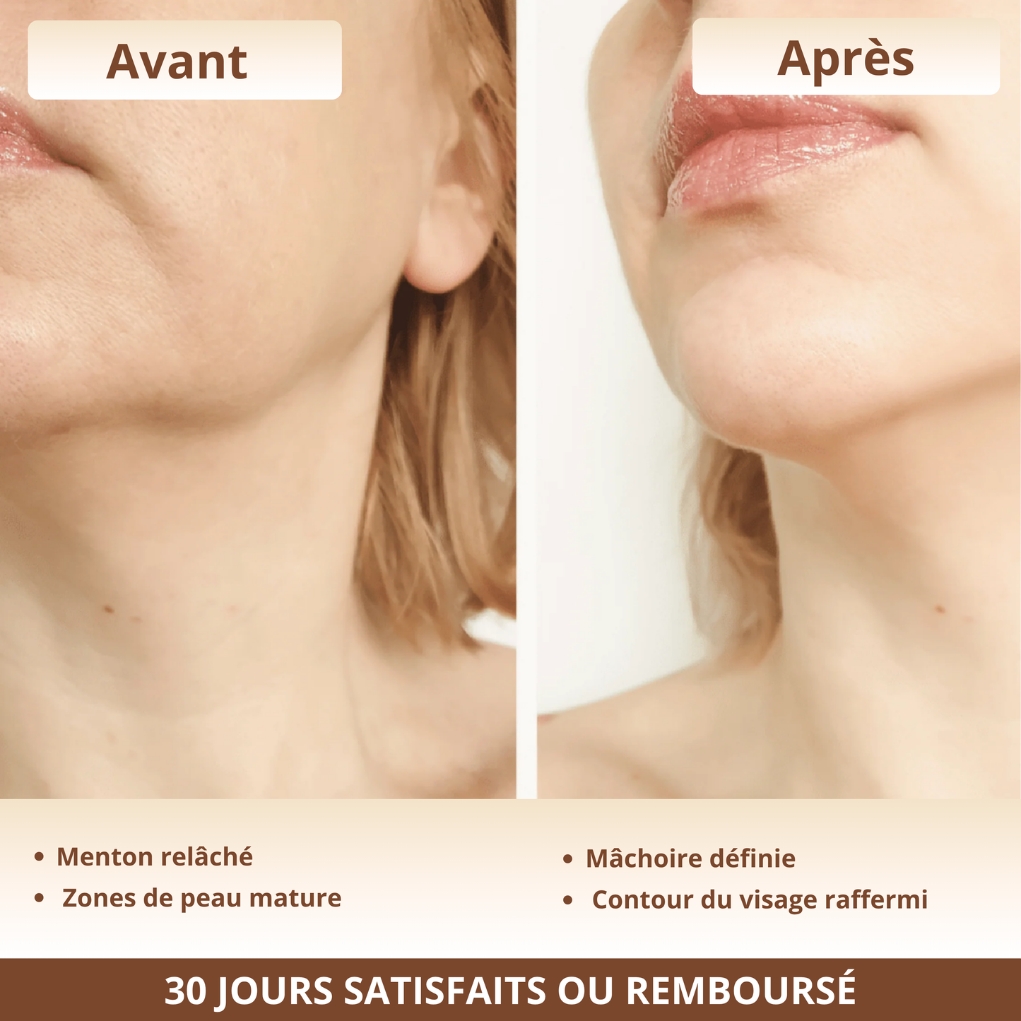 Brosse Lymphatique Celyana™